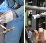 配管（パイプ）の裏波溶接